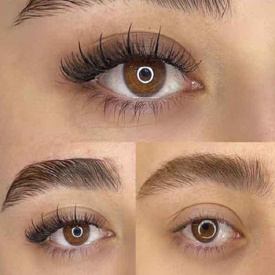 کاشت مژه کارمندی طبیعی